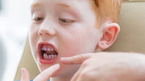 Dental packs for children