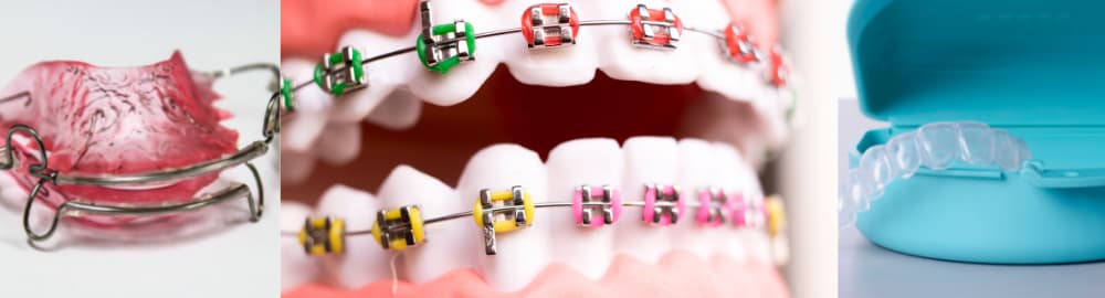 The basics of orthodontics